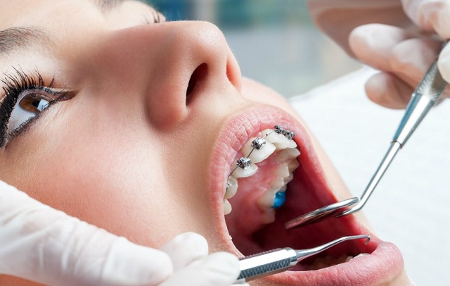 دندانپزشک خوب در تهران