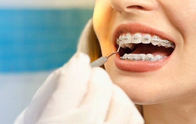 دندانپزشک عالی در ارتودنسی