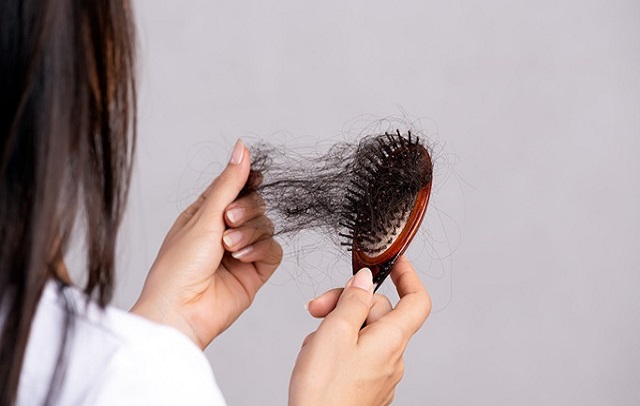 ریزش مو ارثی در زنان