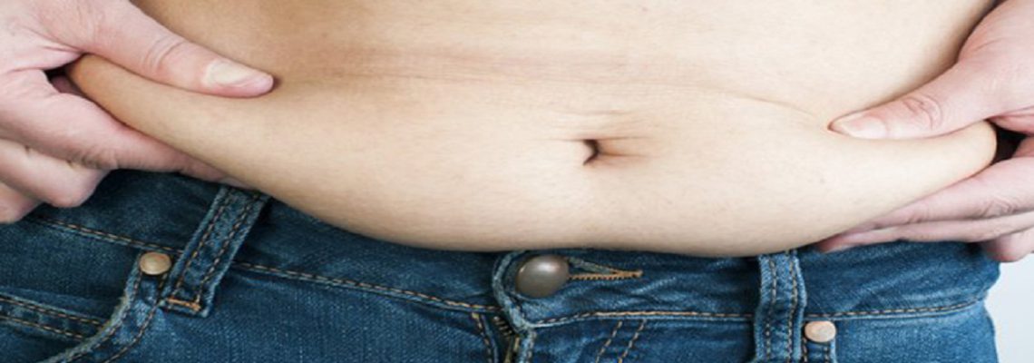 هر آنچه که باید درباره شل شدن پوست شکم بعد از لاغری بدانید