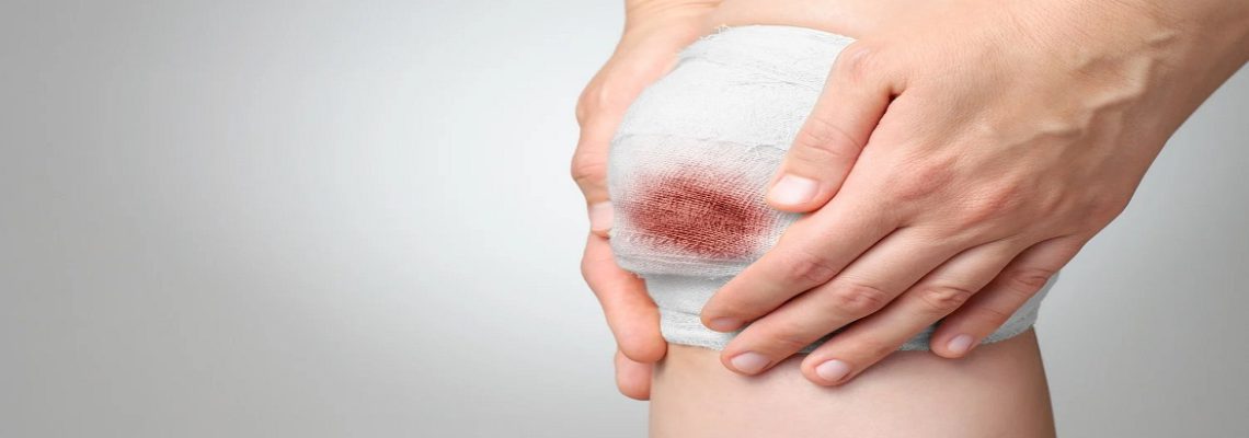 راه های مراقبت از زخم پوست چیست؟