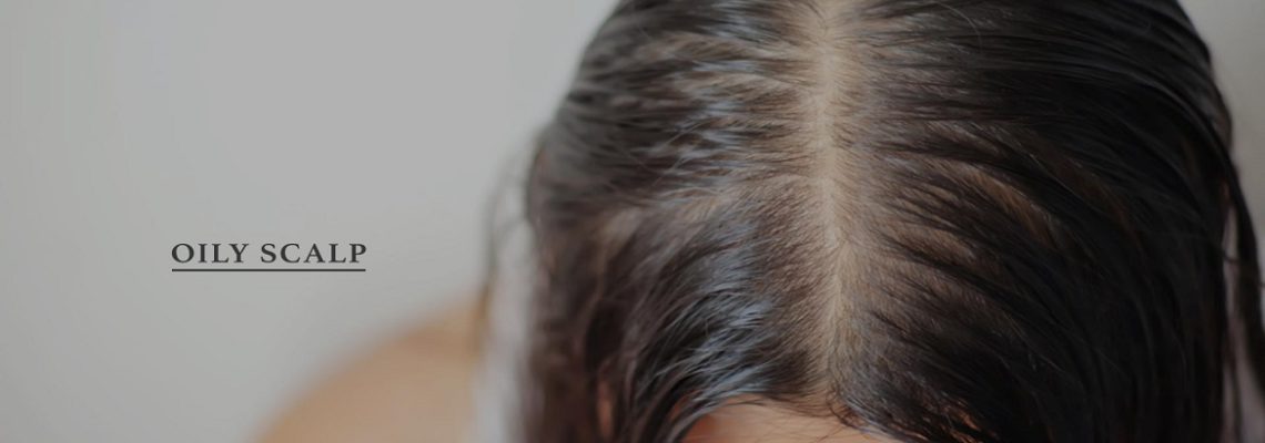 ارتباط چربی پوست سر و ریزش مو چیست؟