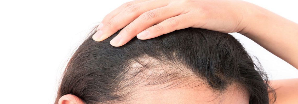 موارد موثر برای جلوگیری از ریزش مو کدامند؟