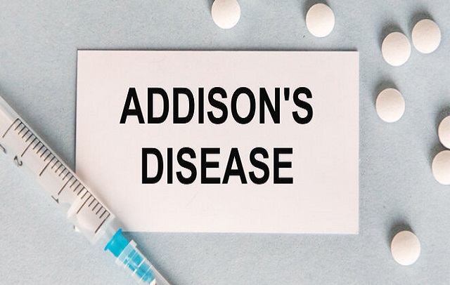 درمان بیماری آدیسون