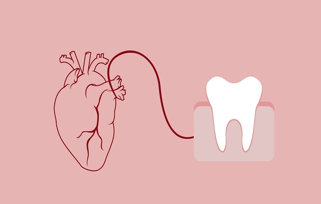 ارتباط بیماری قلبی با دهان و دندان