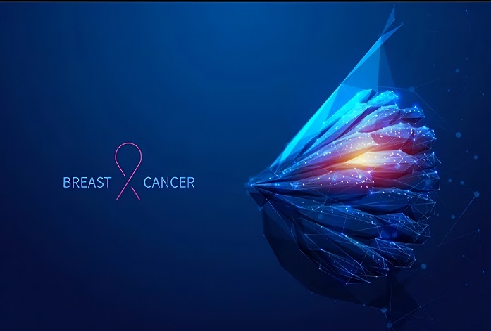  سرطان سینه التهابی : تشخیص، درمان، و راه های پیشگیری