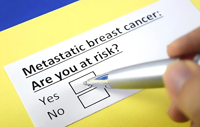 سرطان سینه متاستاتیک