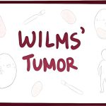 تومور ویلمز