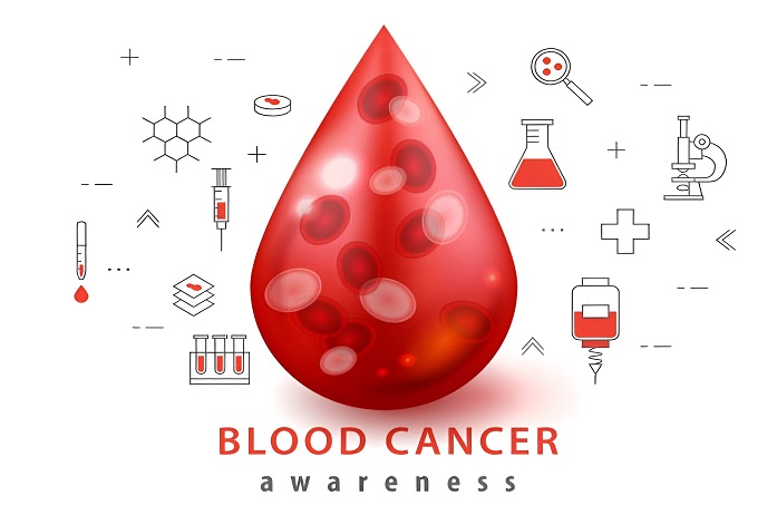  سرطان خون : بررسی عمیق در مورد این بیماری مهلک