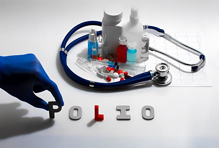 بیماری فلج اطفال (پلیومیلیتیس) : پیشگیری، علائم، درمان و توصیه‌ها