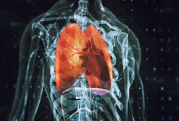 برونشیت: راهنمای جامع برای درک و مدیریت سلامت تنفسی