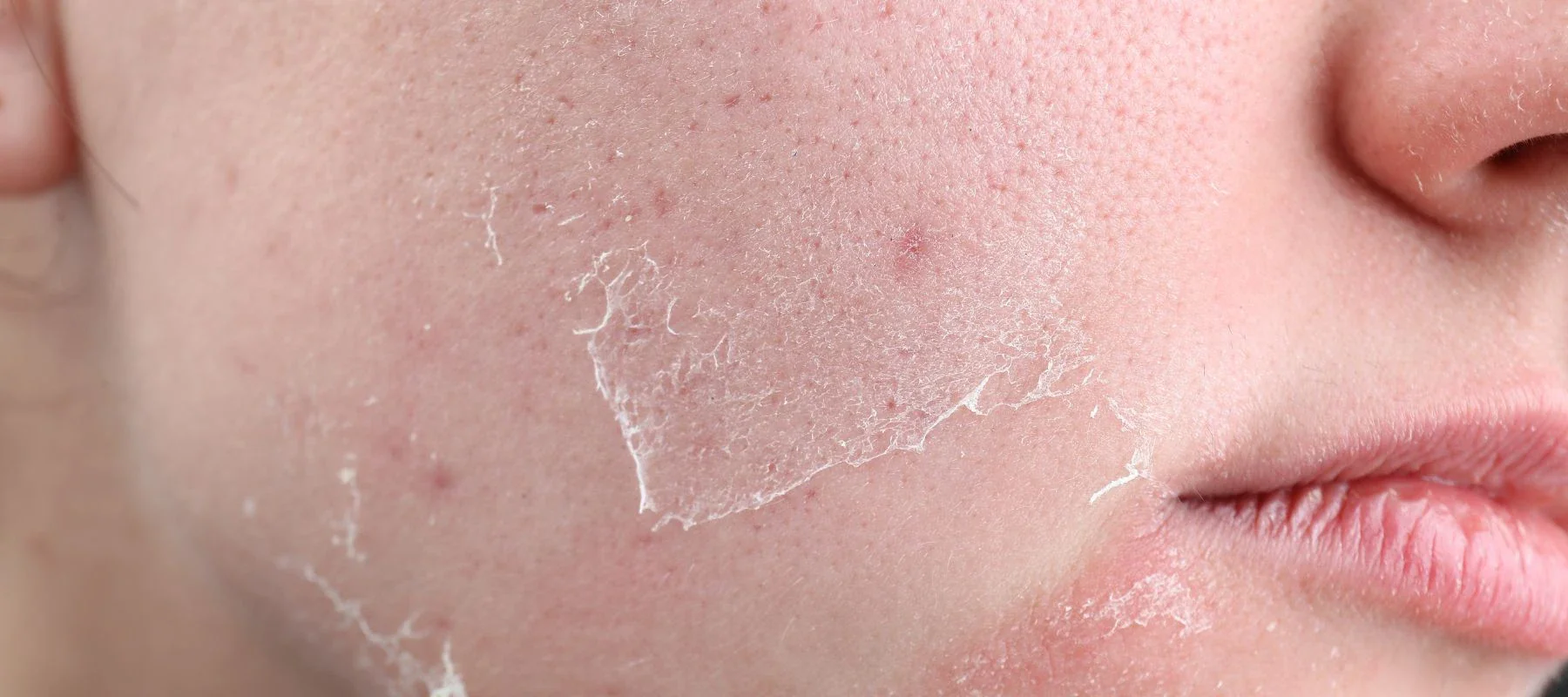 چگونه از تجمع سلول‌های مرده جلوگیری کنیم؟