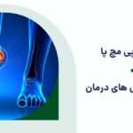 فیزیوتراپی مچ پا؛ راهی مؤثر برای بازگشت به حرکت